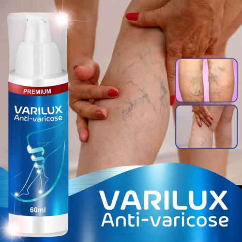 Varilux è una soluzione innovativa progettata per mantenere le vene in salute.